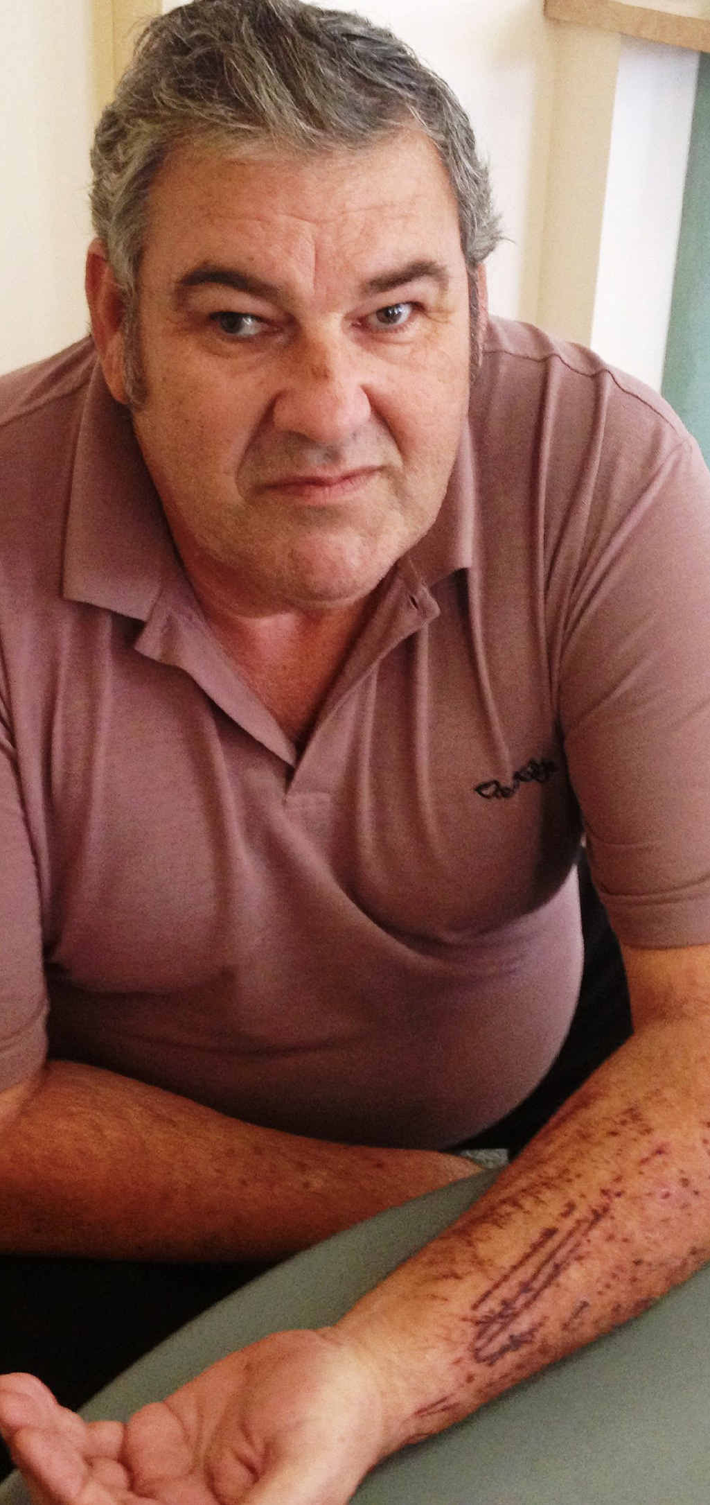 CAT ATTACK: Don the Sawtell budgie breeder was attacked by a feral cat. CAT ATTACK: Don the Sawtell budgie breeder was attacked by a feral cat.